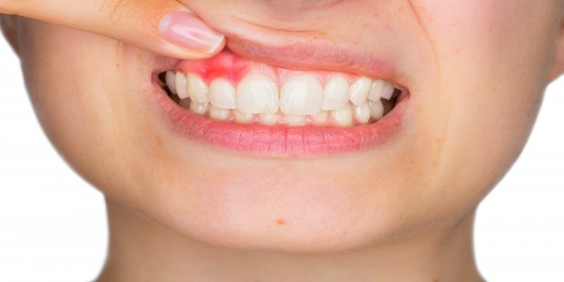 a girl is showing her white teeths
